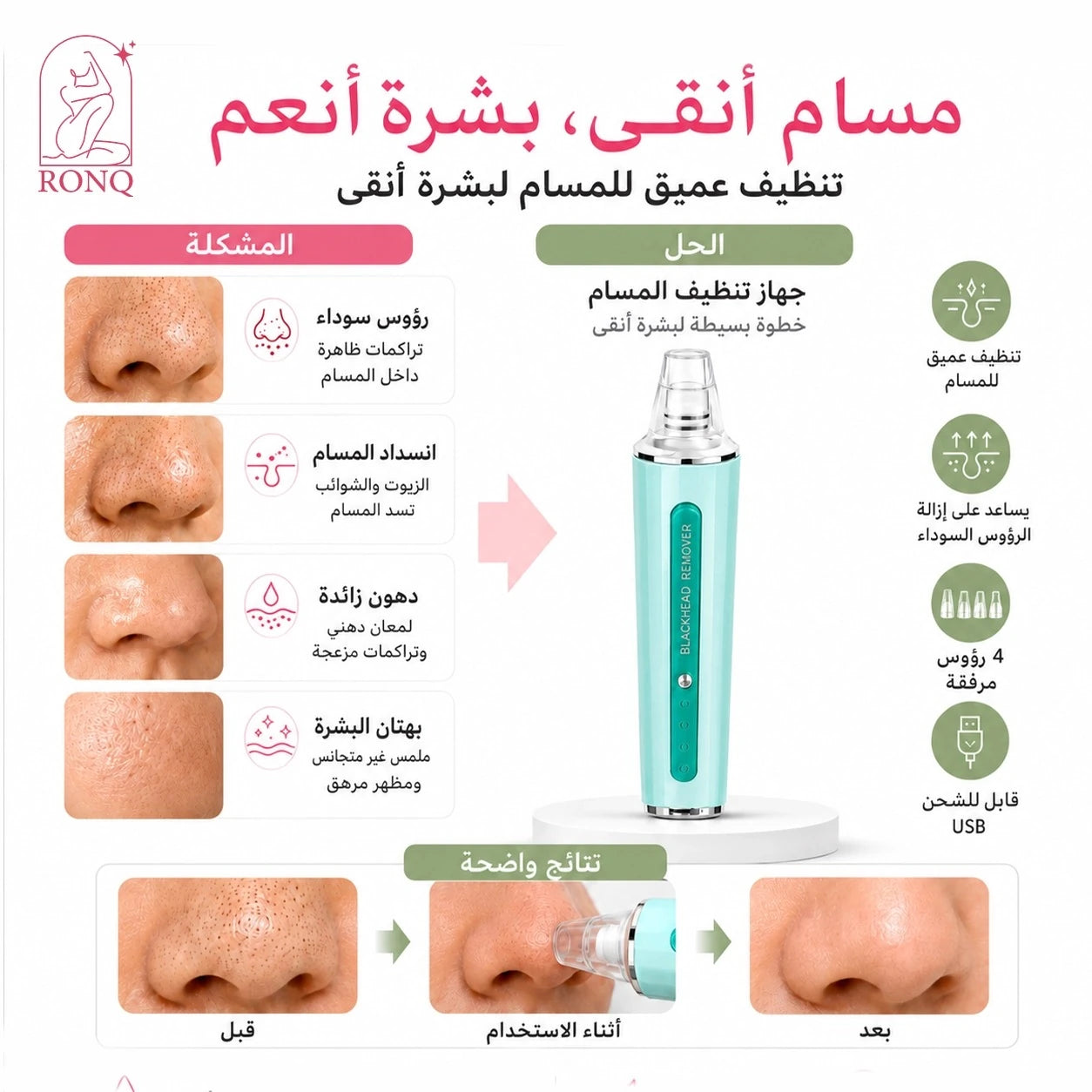 جهاز شفط الرؤوس السوداء — ٤ رؤوس