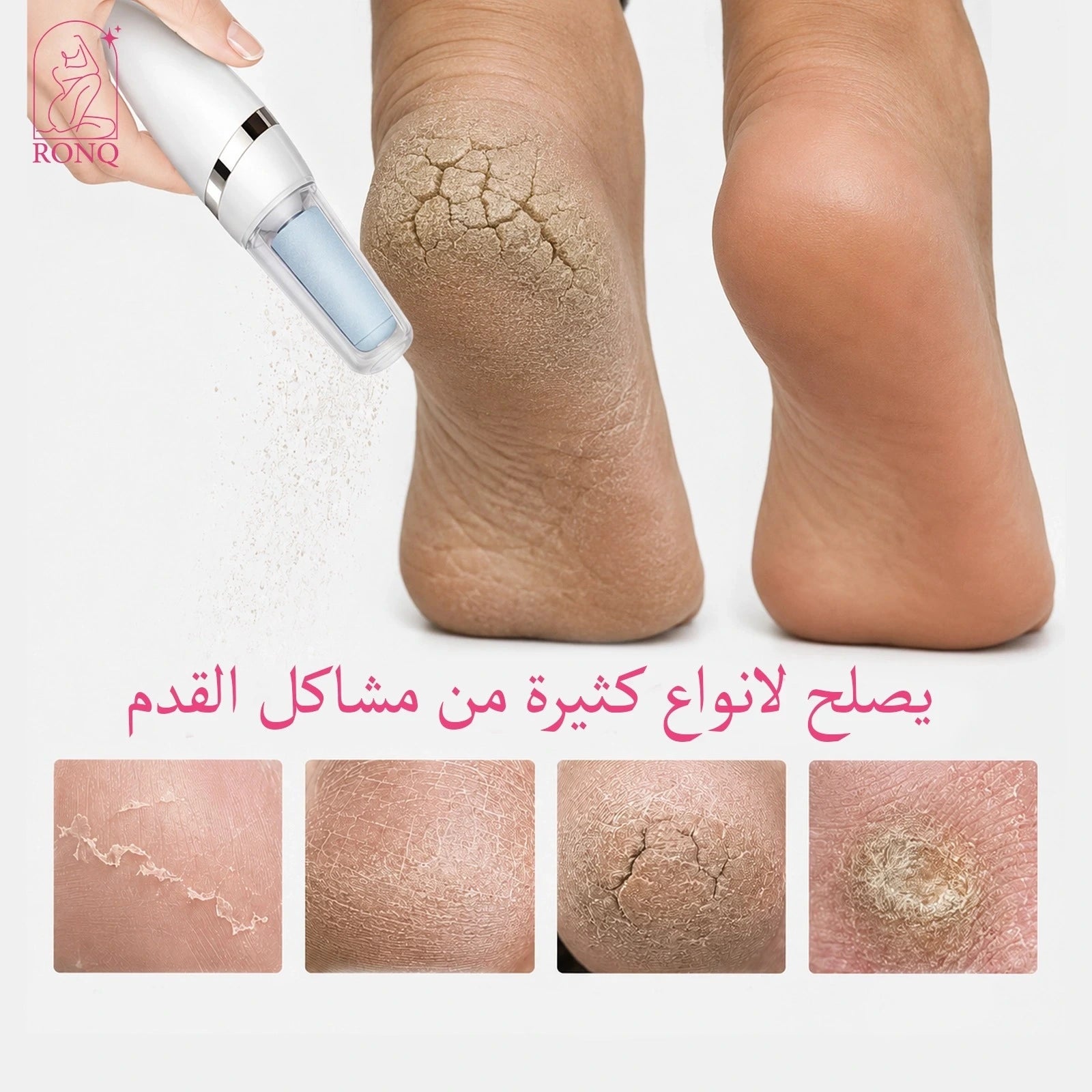 جهاز باديكير للقدم كهربائي