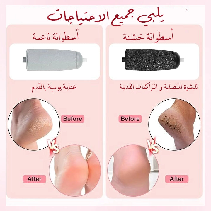 جهاز باديكير للقدم كهربائي